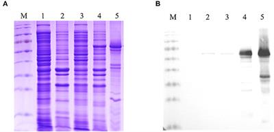 Novel monoclonal antibodies against Fiber-1 of duck adenovirus 3 and their B cell epitopes